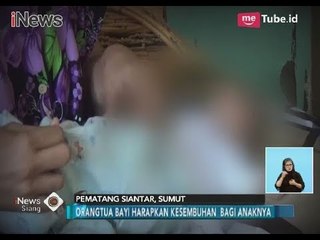 Orang Tua Bayi yang Alami Bocor Jantung Terus Berjuang untuk Kesembuhan Anaknya - iNews Siang 08/02