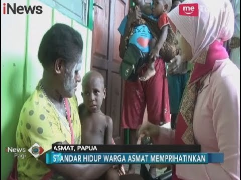 KLB di Asmat Dianggap Membuat Catatan Buruk Kesehatan di Indonesia - iNews Pagi 15/02