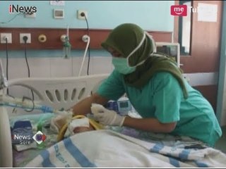 Balita di Karawang Koma 5 Hari Usai Dianiaya Pacar Sang Ibu - iNews Sore 20/03