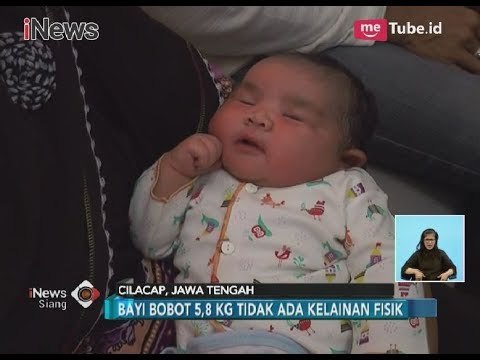 Menggemaskan!! Bayi Cantik Nan Lucu Ini Lahir dengan Berat 5,8 Kilogram - iNews Siang 27/03