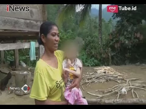 Miris!! Kisah Anak 15 Tahun Pengidap Gizi Buruk yang Hanya Terbaring Lemas - iNews Pagi 07/04