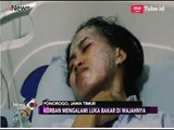 Putus Cinta, Mantan Pacar Siram Janda Cantik di Ponorogo dengan Air Keras - iNews Sore 25/06
