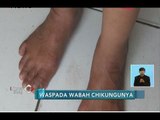 Waspada!! Puluhan Warga Depok Terserang Kelumpuhan Mendadak, Ini Penyebabnya - iNews Siang 30/06