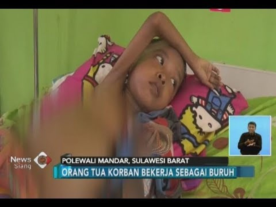 Memprihatinkan!! Bocah Berusia 9 Tahun di Polewali Mandar Mengalami Malnutrisi - iNews Siang 09/07