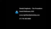 Dental Implants - Bronx Dentist David Pinkhasov DDS