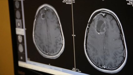 هذا الصباح- فيروس شلل الأطفال قد يكون علاجا للسرطان