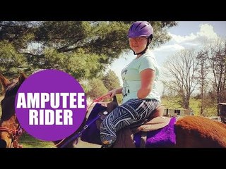 Brave equestrian who had three limbs amputated due to rare condition