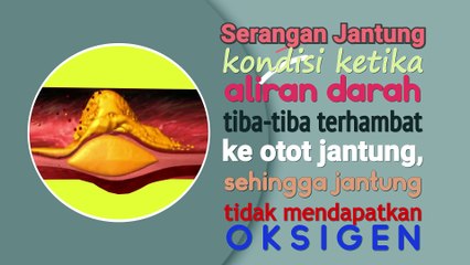 SERANGAN JANTUNG - Faktor Resiko Jantung, Komplikasi