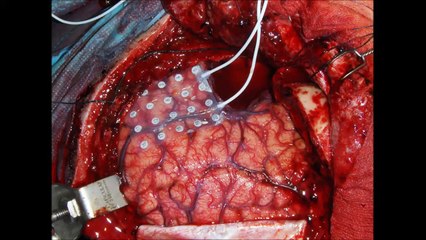 Defect - Malice Machine