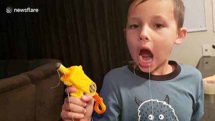Look on boy’s face after removing tooth with Nerf gun is priceless
