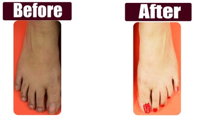 Pedicure at Home: Easy DIY | घर में खुद करे ये आसान पेडिक्योर | Boldsky
