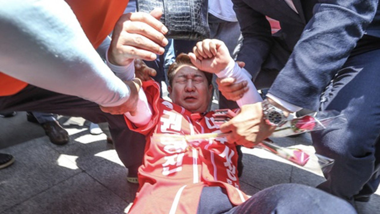[시사 안드로메다] '꼬리뼈 부상' 권영진이 밝힌 당시 심경 "화 났지만..." / YTN