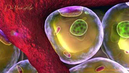 How will weight loss affect the result of the hourglass hip procedure ?