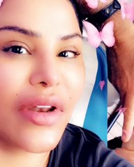 أحلام تخضع لعملية تجميل "الشفاه الألماسية" وهذا شكلها الجديد بلا مكياج