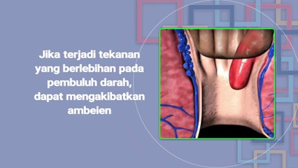 AMBEIEN - Apa Tanda dan Gejala Ambeien