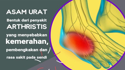 ASAM URAT 1-Pengertian dan penyebab