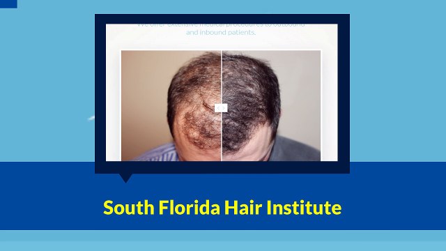 Hair Implants Plantation - South Florida Hair Institute (954) 472-8355