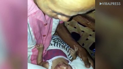 Two-month-old Baby Girl With Large Head Growth