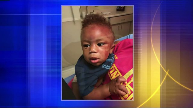 Daycare Worker Charged with Neglect After Older Boy `Stomped` on Eight-Month-Old in Her Care