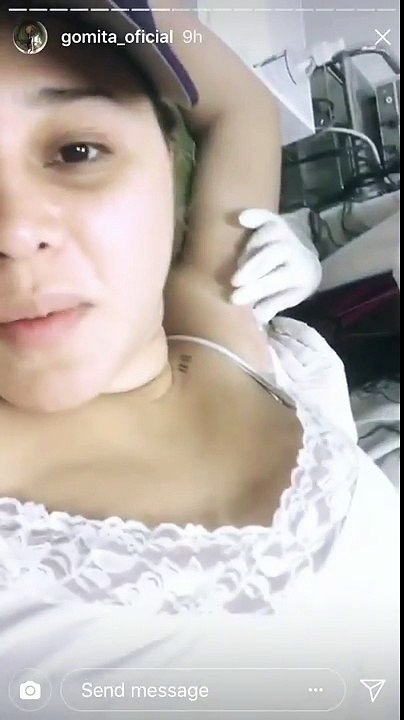 Gomita se inyecta botox en la axila para no sudar