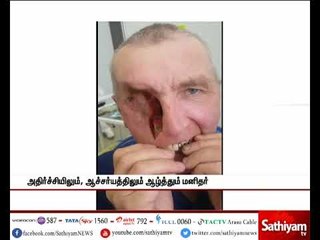 கண், பற்களை தனியாக எடுக்கும் மனிதர்