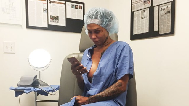 What Facial Feminization Surgery Means