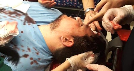 Saldırgan Baba, Çocuğun Ateşi Düşmeyince Doktorun Başında Parke Taşı Parçaladı