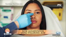 DERMAESTHETIQUE: Nose job using hyaluronic acid