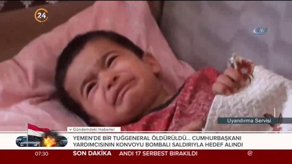 İki yaşında oynadığı düdüklü tencereye sıkışınca imdada