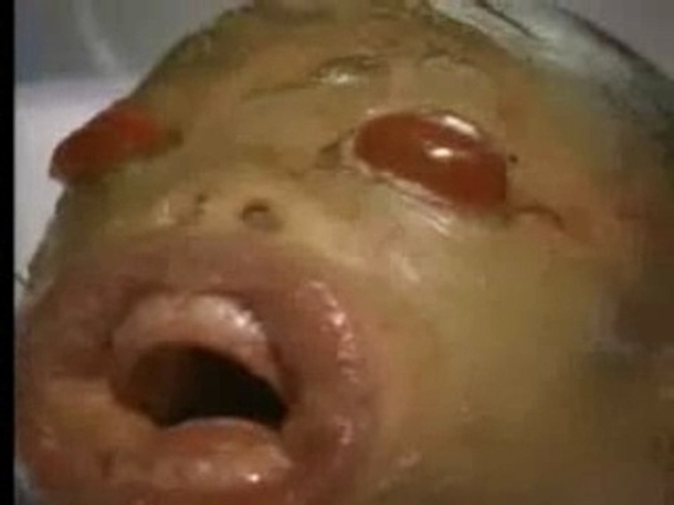 Deformed child