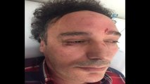 Ümraniye'de Doktora Saldırı