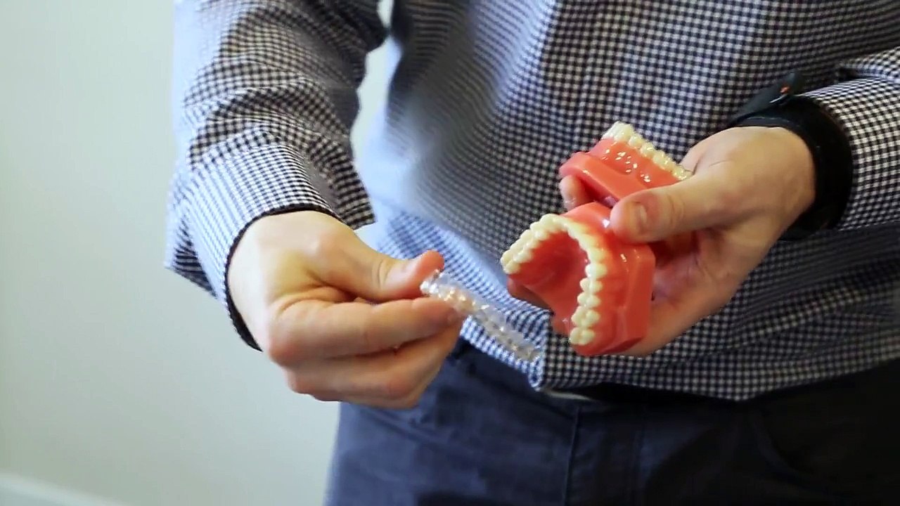 Invisalign®