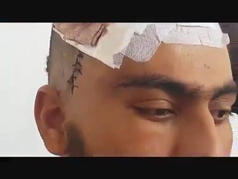 هموطنان عزیز لطفا به این هموطن تان کمک کنید سخت نیاز به کمک های شما دارد. مطمئن باشید کمک شما حتما به وی میرسد و برایتان بخاطر اثبات ویدیو بعدی نشر میکنیم.درن