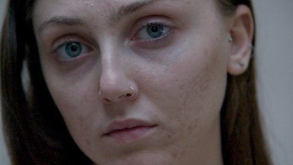 Is Acne the Final Frontier of Body Positivity?