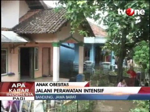 Bocah Berbobot 198 Kg Ditangani 13 Dokter Spesialis