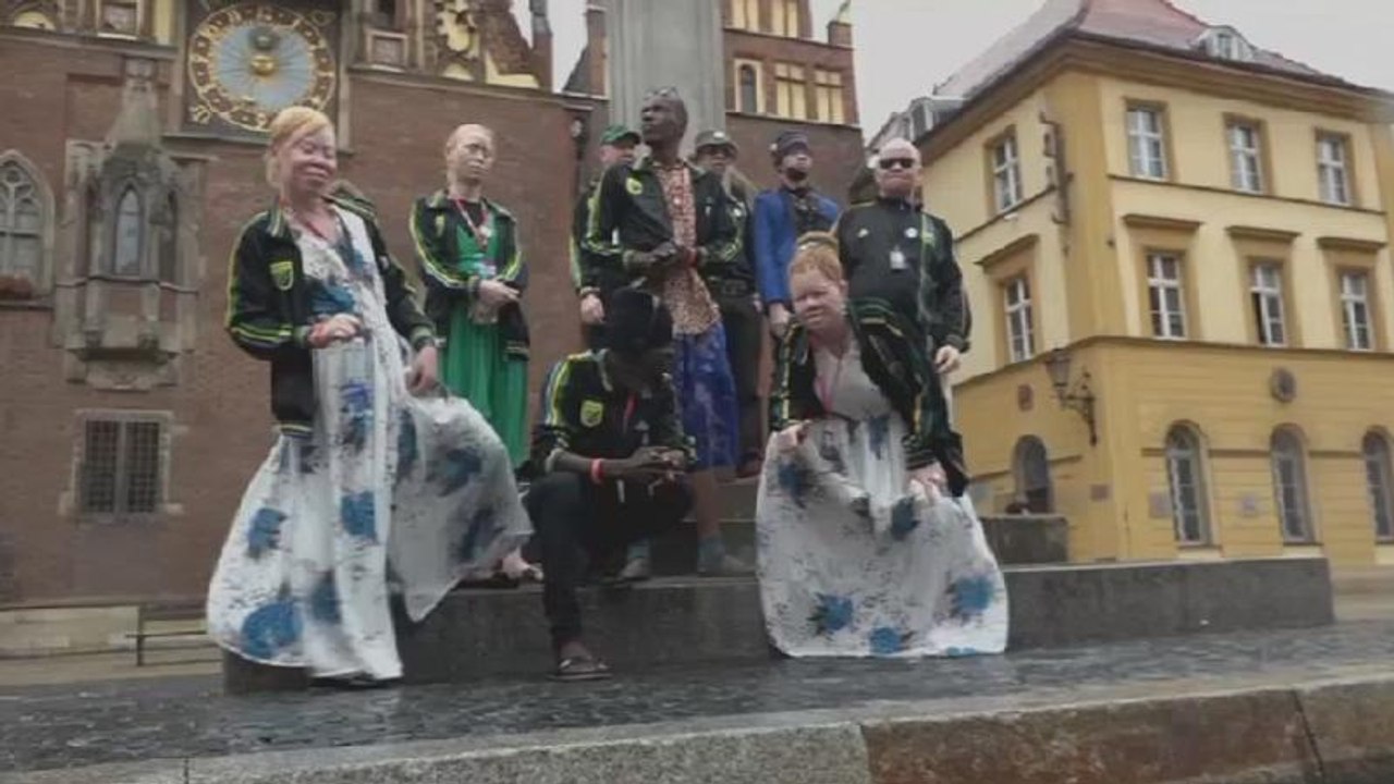 Une troupe d'albinos contre la violence