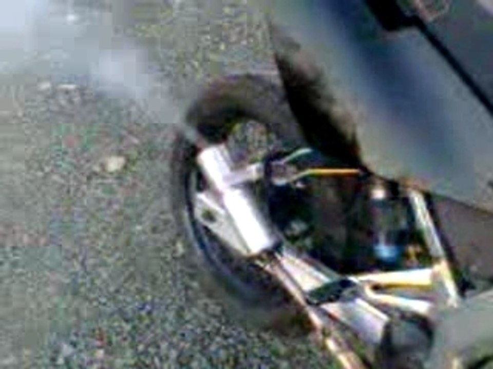 bruit de la drd