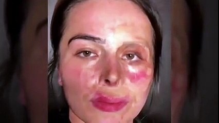 بنت احترق وجهها قبل يوم زفافها شاهد ماذا فعلت الماكيره بها