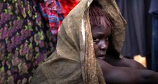 Somali'de, Sünnet Edilen 10 Yaşındaki Kız Çocuğu Kan Kaybından Öldü