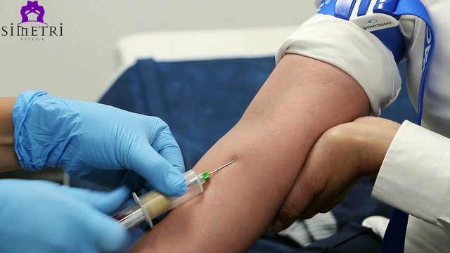 PRP Uygulaması (Kök Hücre)