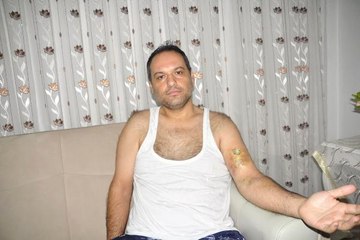 Tartıştığı Hasta Bakıcı Kolunu Isırdı: 4 Santimlik Yırtık Oluştu