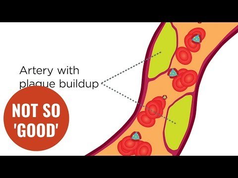 'Good' cholesterol may actually increase the risk of heart disease in older women