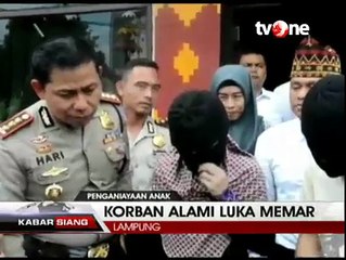 Bocah 11 Tahun Disiksa Ibu Kandung dan Ayah Tiri