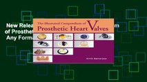 New Releases The Illustrated Compendium of Prosthetic Heart Valves  Any Format