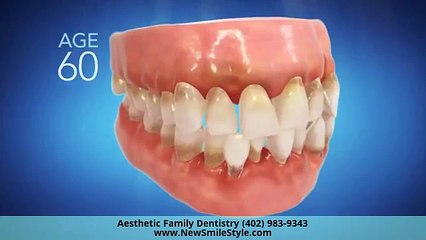 Invisalign in Omaha, NE 🦷