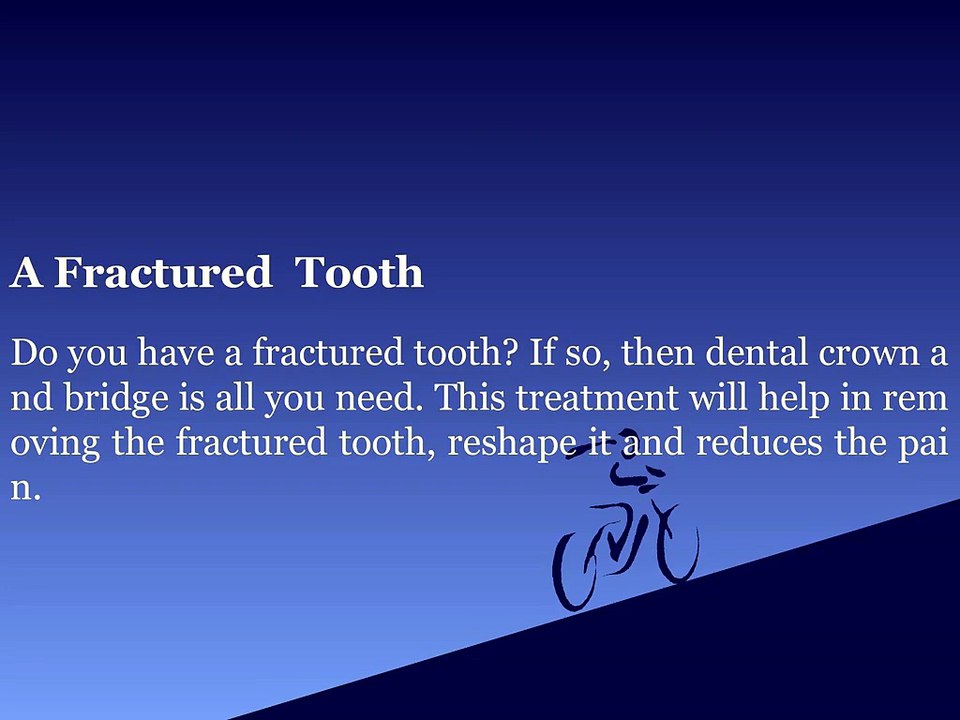 4 Reasons You May Need Dental Crowns and Bridges