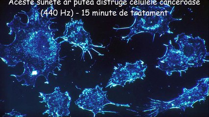 Aceste sunete ar putea distruge celulele canceroase (440 Hz) - 15 minute de tratament