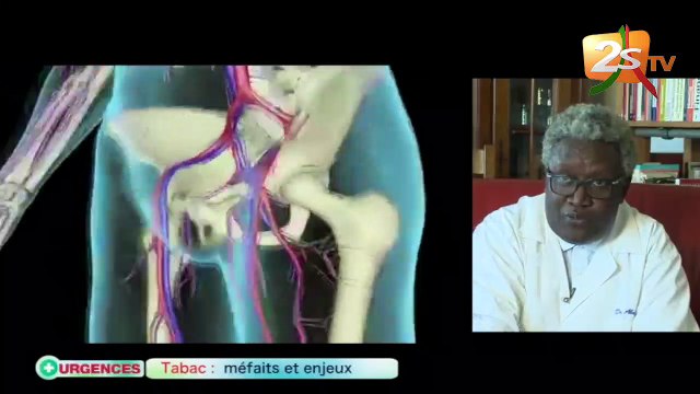 URGENCES DU 26 JUILLET 2018 AVEC MOUSSA SÉNE - TABAC, MÉFAITS ET ENJEUX