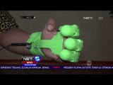 Robot Tangan Bionic Pertama Kali Dikembangkan Di Indonesia-NET5