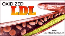 What is Oxidized LDL?